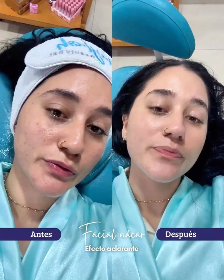 ✨ Atrévete a imaginar tu propio antes y después… el primer paso es más fácil de&hellip;