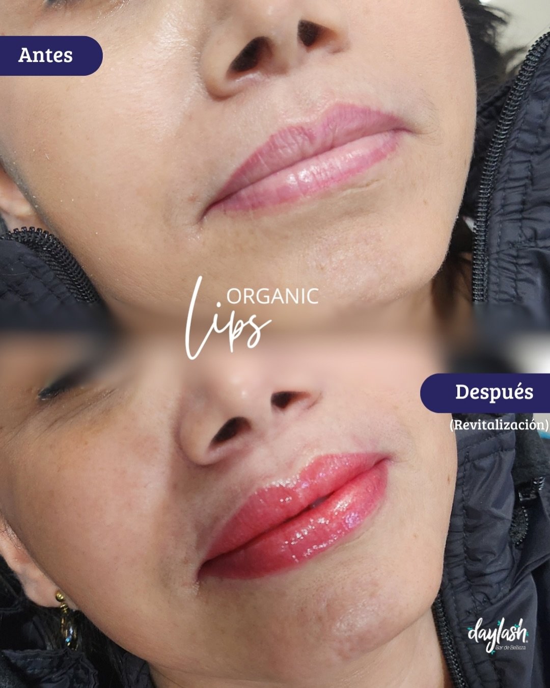 De unos labios apagados a unos llena de vida y color natural. ✨💋 Si sientes que&hellip;